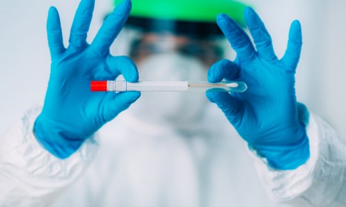 Procedura za PCR testiranje na COVID-19 u Supetru